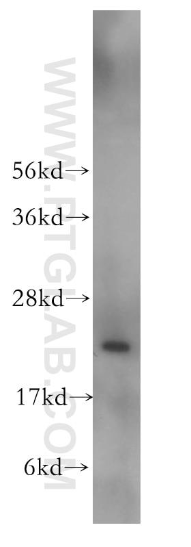 WB analysis of Y79 using 12353-1-AP