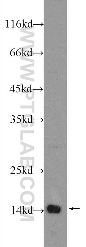 WB analysis of mouse testis using 24672-1-AP