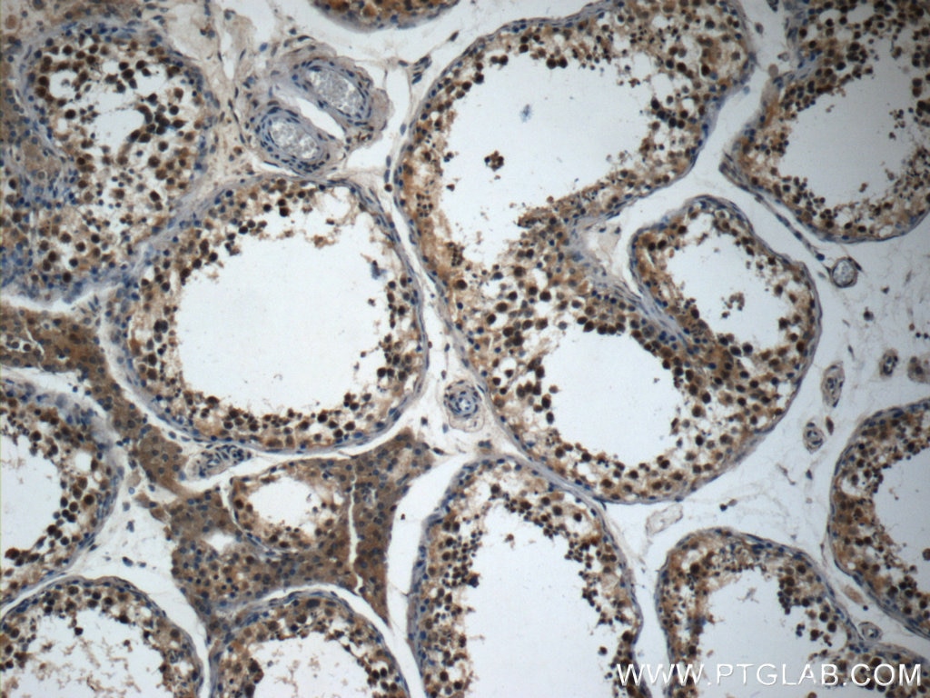 Immunohistochemistry (IHC) staining of human testis tissue using TAF15 Polyclonal antibody (24235-1-AP)