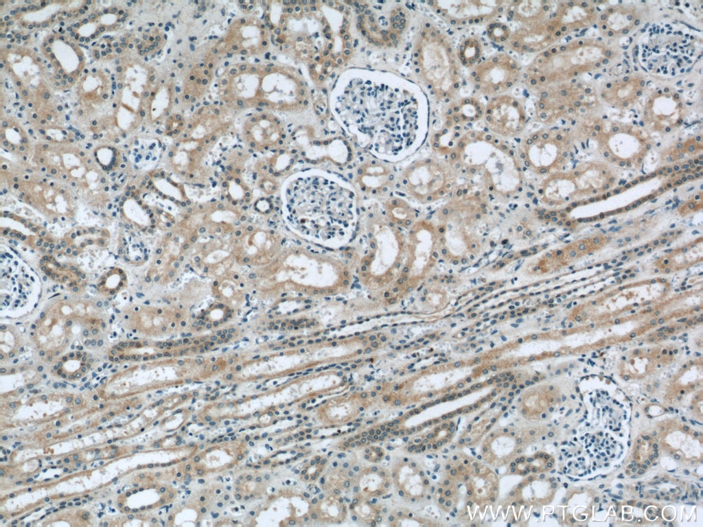 Immunohistochemistry (IHC) staining of human kidney tissue using TAF15 Polyclonal antibody (24235-1-AP)