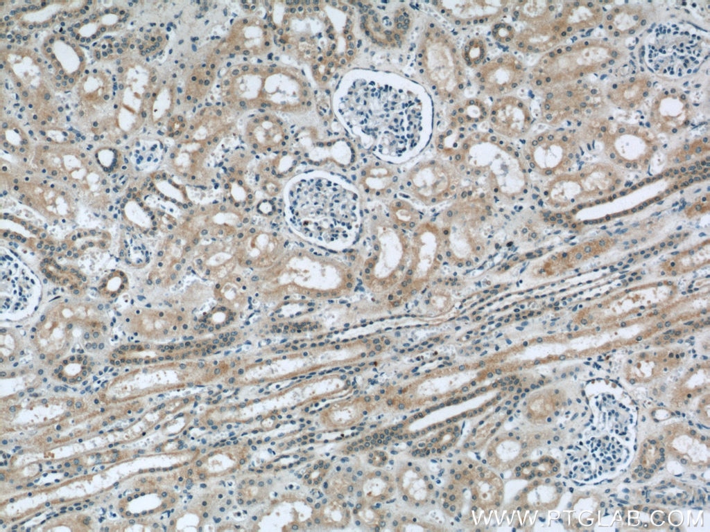 IHC staining of human kidney using 24235-1-AP