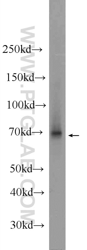 Western Blot (WB) analysis of HEK-293 cells using TAF15 Polyclonal antibody (24235-1-AP)