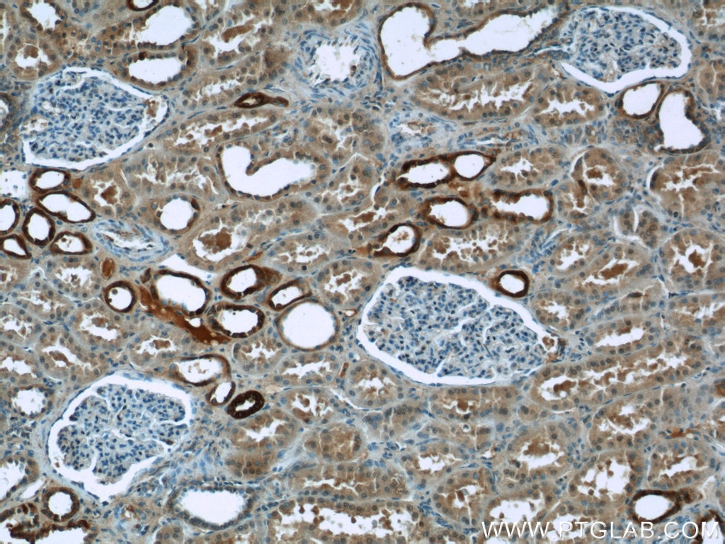 Immunohistochemistry (IHC) staining of human kidney tissue using TAF15 Polyclonal antibody (25521-1-AP)