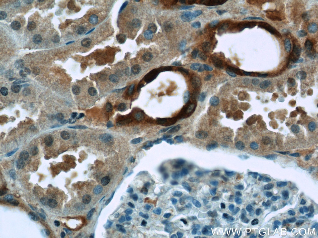 Immunohistochemistry (IHC) staining of human kidney tissue using TAF15 Polyclonal antibody (25521-1-AP)