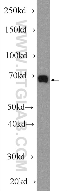 Western Blot (WB) analysis of HEK-293 cells using TAF15 Polyclonal antibody (25521-1-AP)