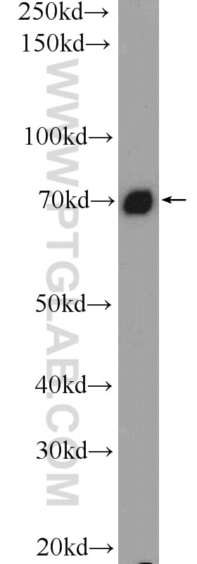 Western Blot (WB) analysis of HeLa cells using TAF15 Polyclonal antibody (25521-1-AP)