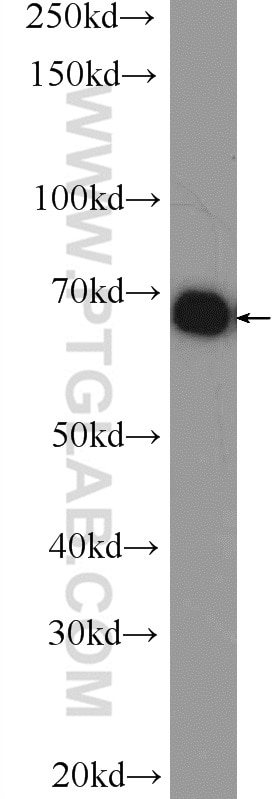 Western Blot (WB) analysis of Jurkat cells using TAF15 Polyclonal antibody (25521-1-AP)