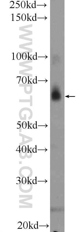 Western Blot (WB) analysis of mouse brain tissue using TAF15 Polyclonal antibody (25521-1-AP)