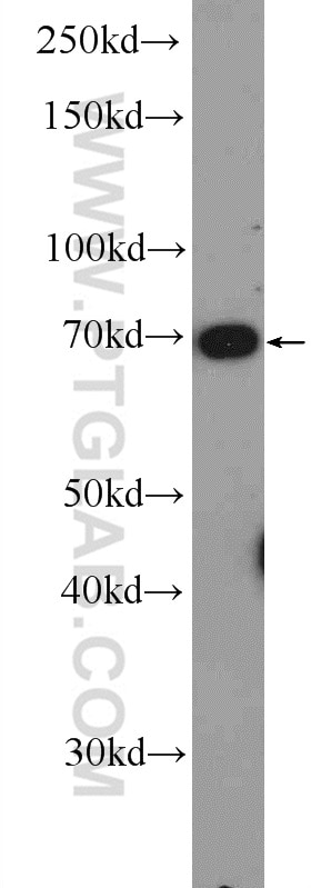 Western Blot (WB) analysis of SH-SY5Y cells using TAF15 Polyclonal antibody (25521-1-AP)