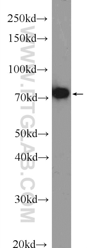 Western Blot (WB) analysis of A549 cells using TAF15 Polyclonal antibody (25521-1-AP)