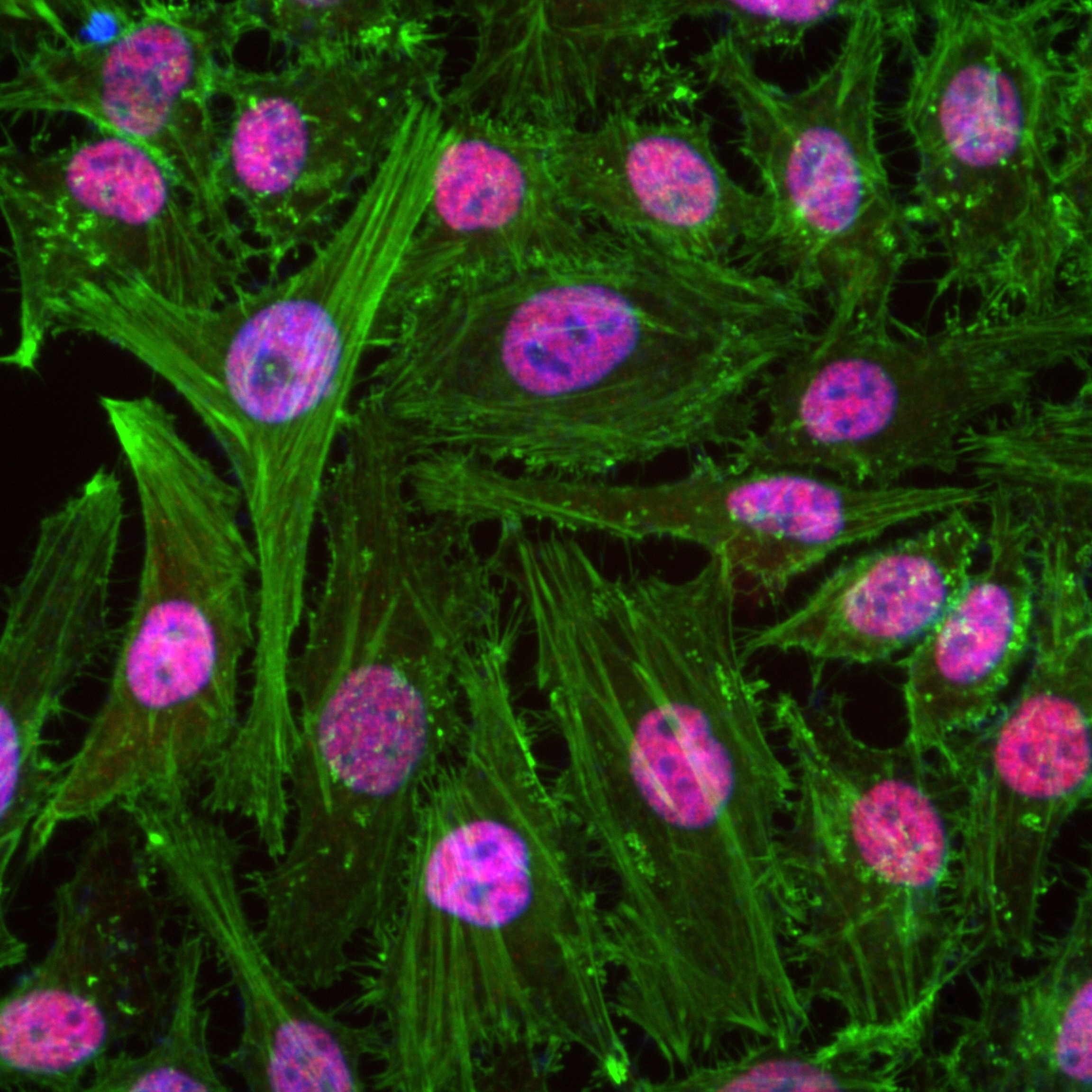 Immunofluorescence (IF) / fluorescent staining of HeLa cells using TAF15 Recombinant antibody (82860-1-RR)