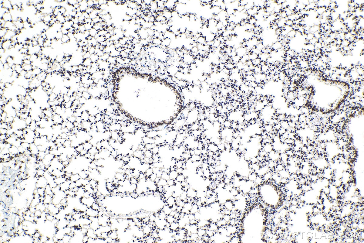 Immunohistochemistry (IHC) staining of mouse lung tissue using TAF15 Recombinant antibody (82860-1-RR)
