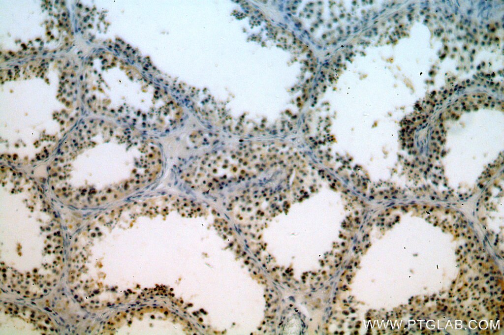Immunohistochemistry (IHC) staining of human testis tissue using TAF1B Polyclonal antibody (12818-1-AP)