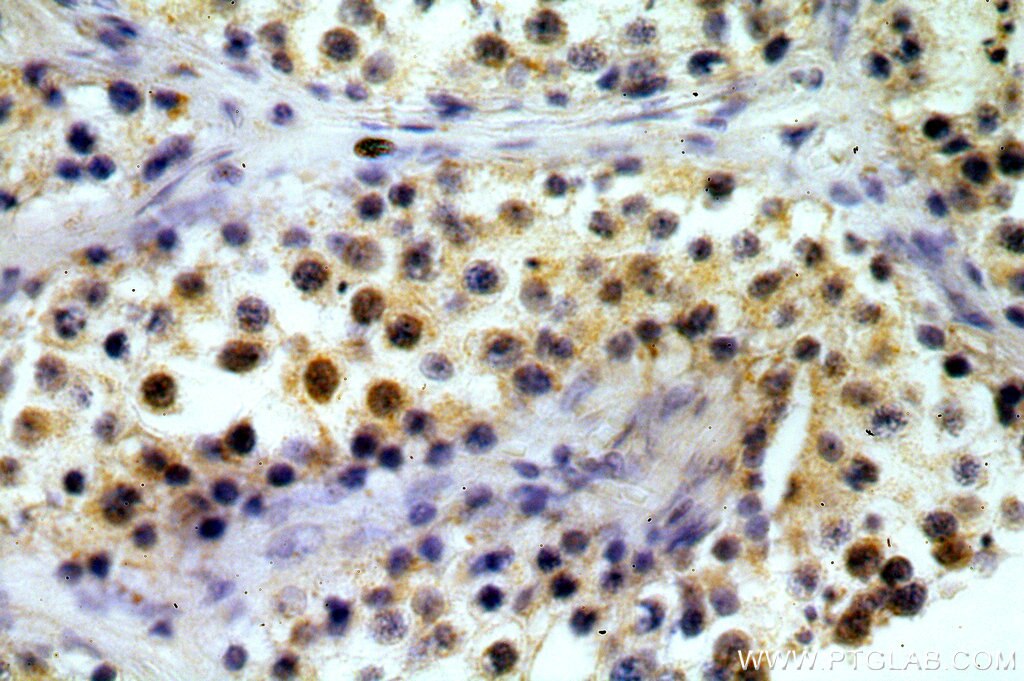Immunohistochemistry (IHC) staining of human testis tissue using TAF1B Polyclonal antibody (12818-1-AP)