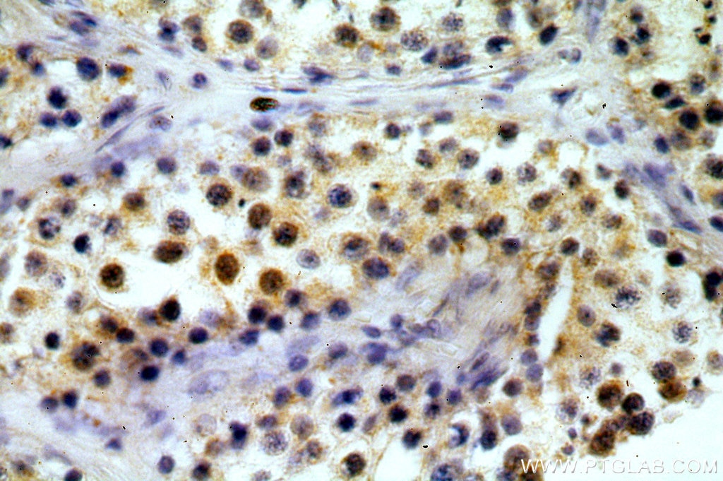 IHC staining of human testis using 12818-1-AP