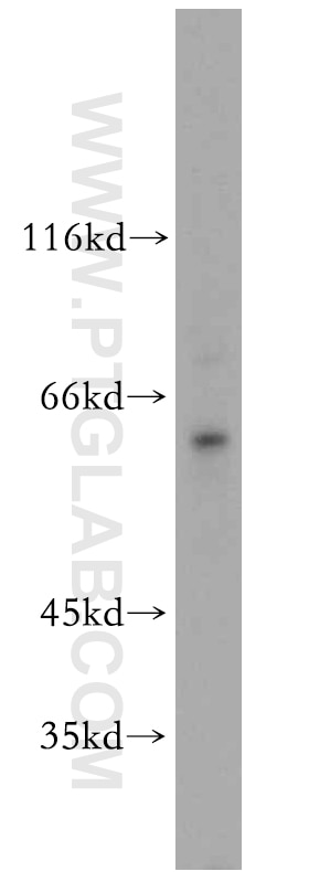 Western Blot (WB) analysis of HeLa cells using TAF1B Polyclonal antibody (12818-1-AP)