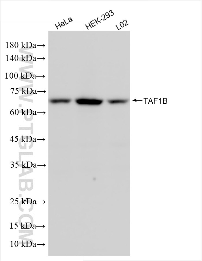 Western Blot (WB) analysis of HeLa cells using TAF1B Recombinant antibody (85885-4-RR)