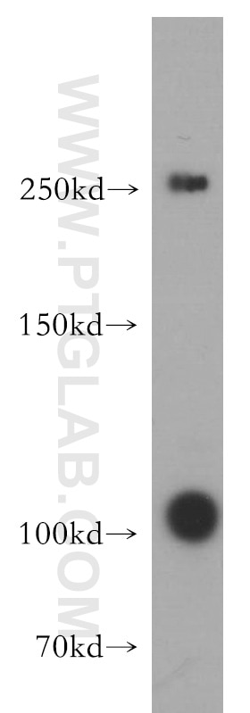 Western Blot (WB) analysis of human testis tissue using TAF1L Polyclonal antibody (55170-1-AP)