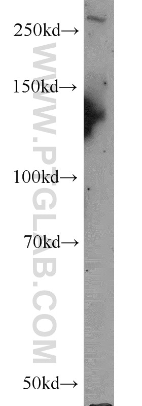 Western Blot (WB) analysis of DU 145 cells using TAF1L Polyclonal antibody (55170-1-AP)