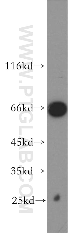 Western Blot (WB) analysis of Jurkat cells using TAF5L Polyclonal antibody (19274-1-AP)
