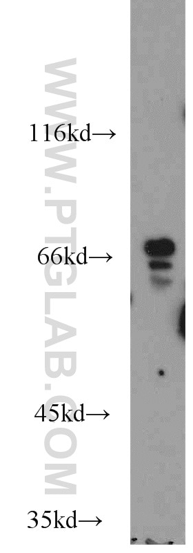 Western Blot (WB) analysis of mouse thymus tissue using TAF6L Polyclonal antibody (15745-1-AP)