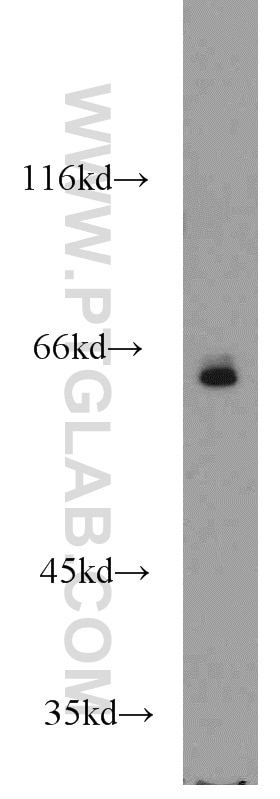Western Blot (WB) analysis of Jurkat cells using TAF6L Polyclonal antibody (15745-1-AP)