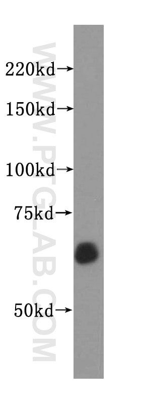 Western Blot (WB) analysis of Raji cells using TAF6L Polyclonal antibody (15745-1-AP)