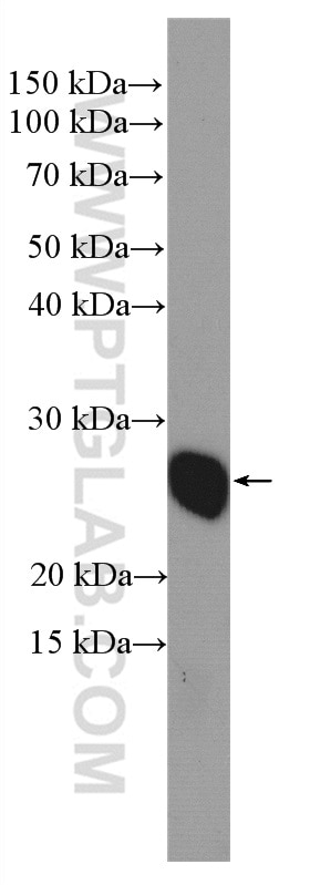 Western Blot (WB) analysis of HeLa cells using TAF9 Polyclonal antibody (10544-1-AP)
