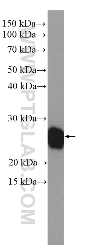 WB analysis of MCF-7 using 10544-1-AP