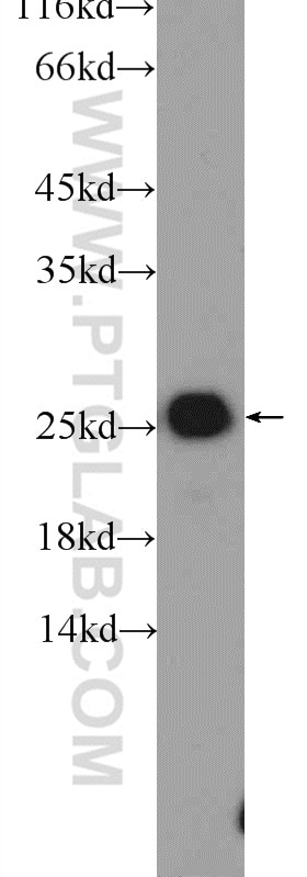 Western Blot (WB) analysis of HeLa cells using TAF9 Polyclonal antibody (10544-1-AP)