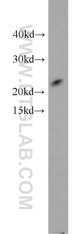 Western Blot (WB) analysis of MCF-7 cells using TAF9 Polyclonal antibody (10544-1-AP)