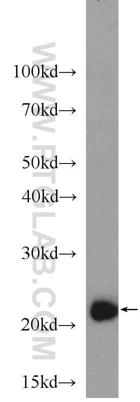 Western Blot (WB) analysis of HEK-293 cells using TAF9 Polyclonal antibody (10544-1-AP)