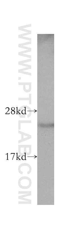 Western Blot (WB) analysis of human colon tissue using TAF9 Polyclonal antibody (10544-1-AP)