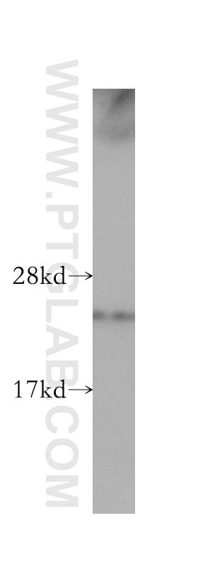 Western Blot (WB) analysis of human skeletal muscle tissue using TAF9 Polyclonal antibody (10544-1-AP)