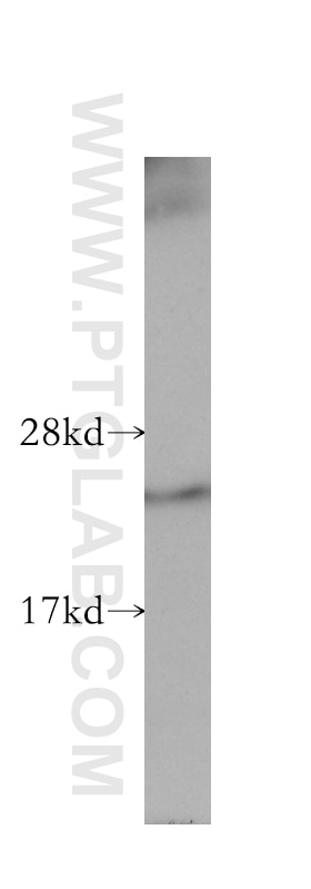 Western Blot (WB) analysis of human heart tissue using TAF9 Polyclonal antibody (10544-1-AP)