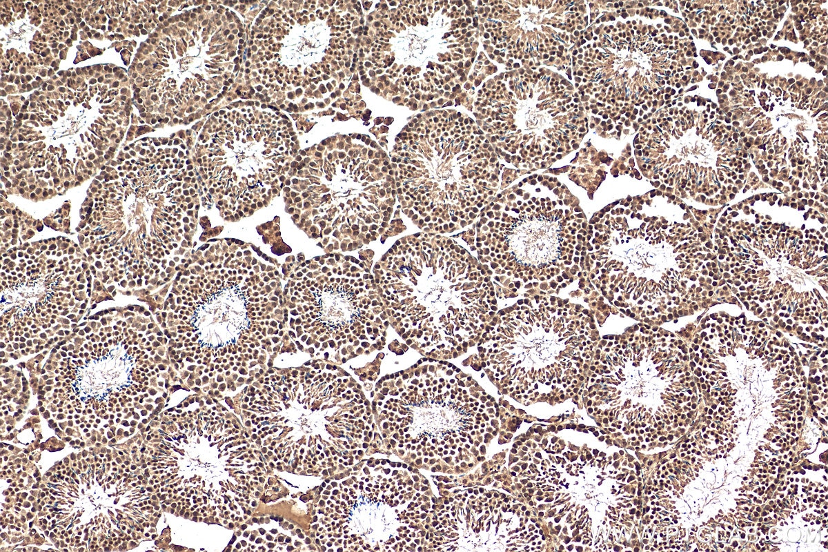 Immunohistochemistry (IHC) staining of mouse testis tissue using TAF9B Polyclonal antibody (28713-1-AP)