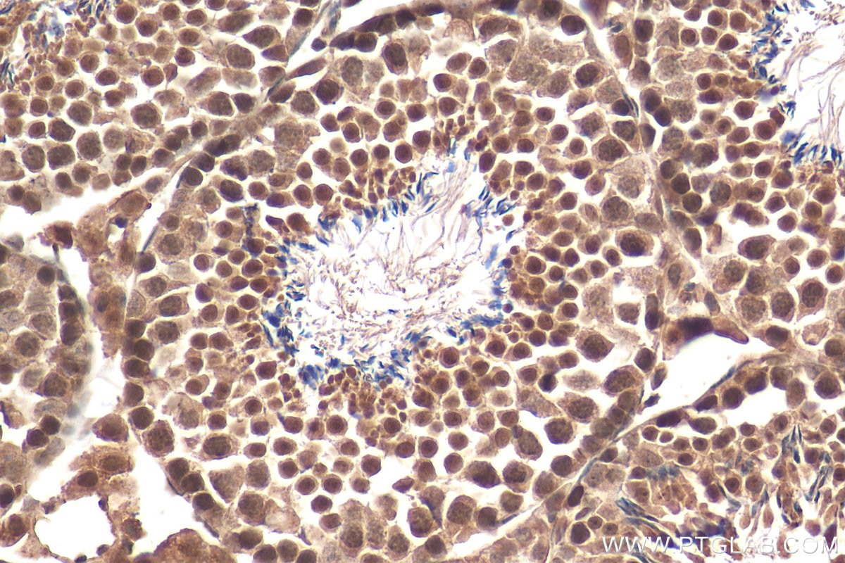 Immunohistochemistry (IHC) staining of mouse testis tissue using TAF9B Polyclonal antibody (28713-1-AP)