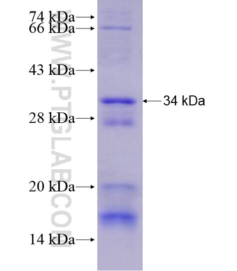 TAF9B fusion protein Ag28863 SDS-PAGE TAF9B fusion protein Ag28863 SDS-PAGE