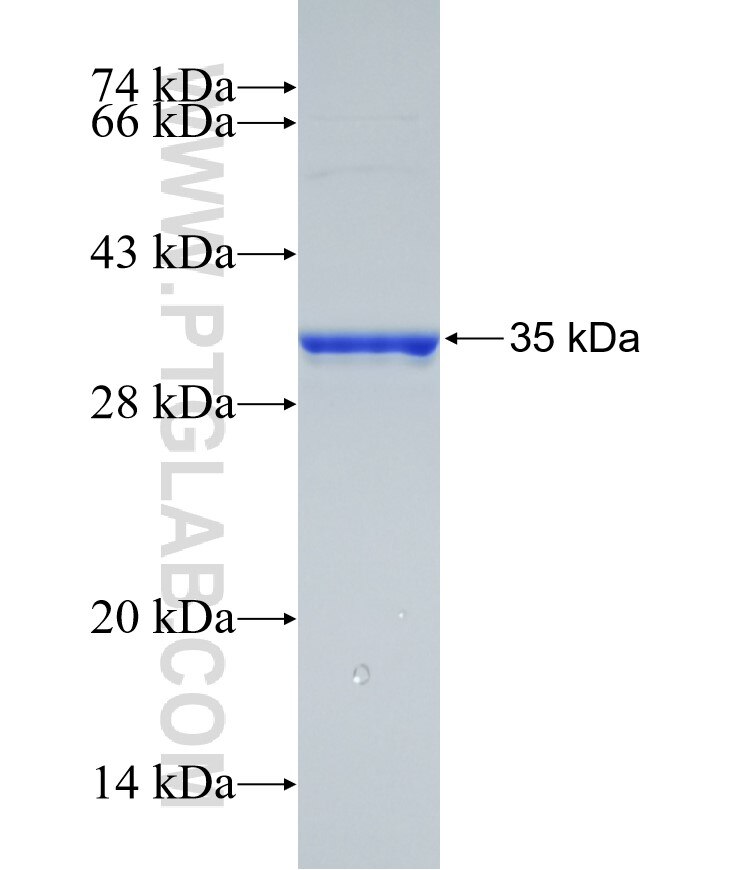 TAF9B fusion protein Ag29615 SDS-PAGE
