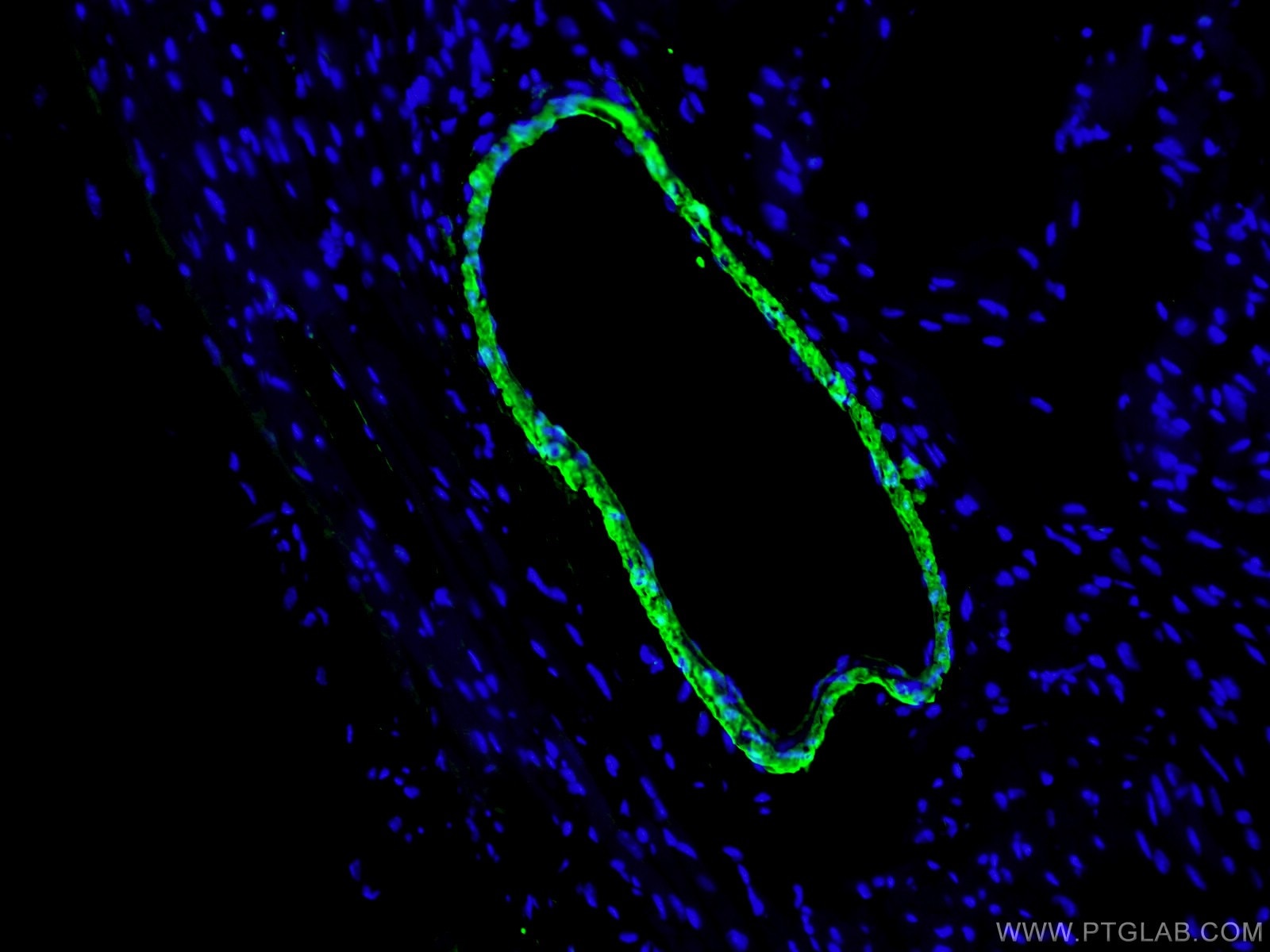 Immunofluorescence (IF) / fluorescent staining of mouse heart tissue using transgelin/SM22 Polyclonal antibody (10493-1-AP)