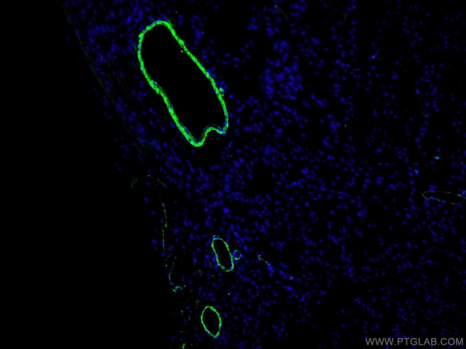 Immunofluorescence (IF) / fluorescent staining of mouse heart tissue using transgelin/SM22 Polyclonal antibody (10493-1-AP)