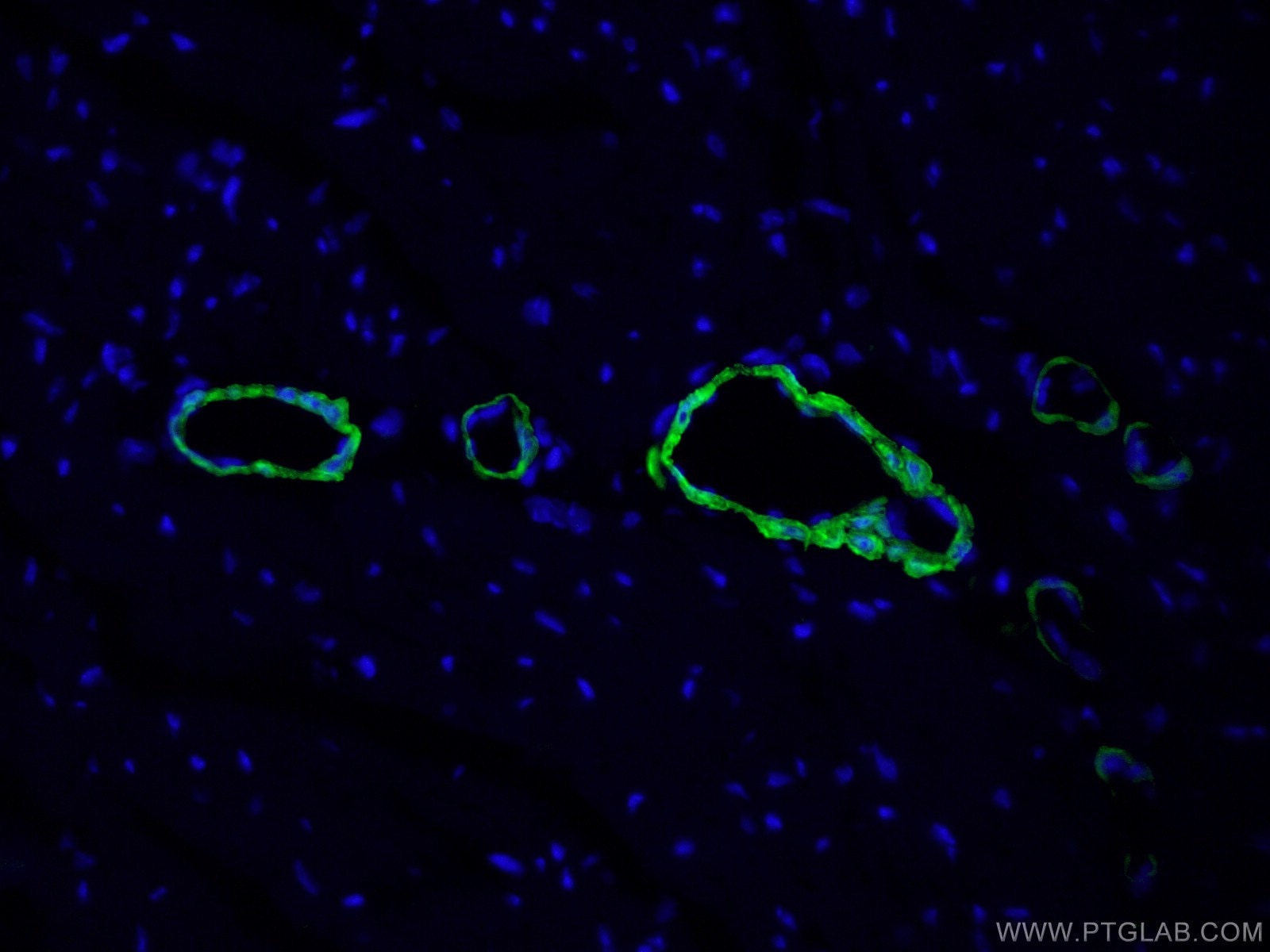 IF Staining of mouse heart using 10493-1-AP