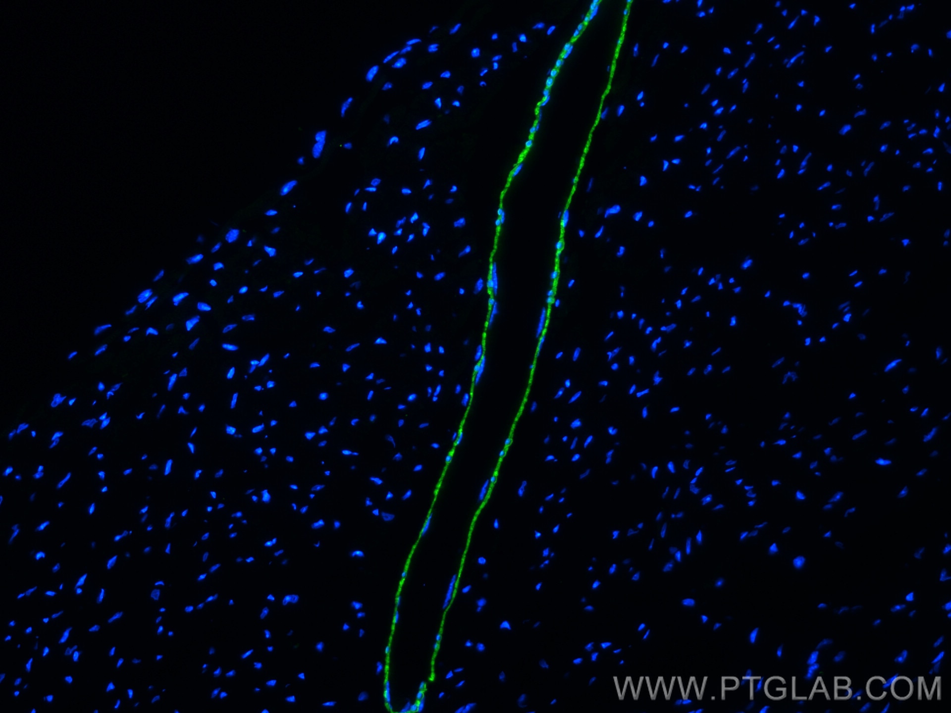 IF Staining of mouse heart using 10493-1-AP