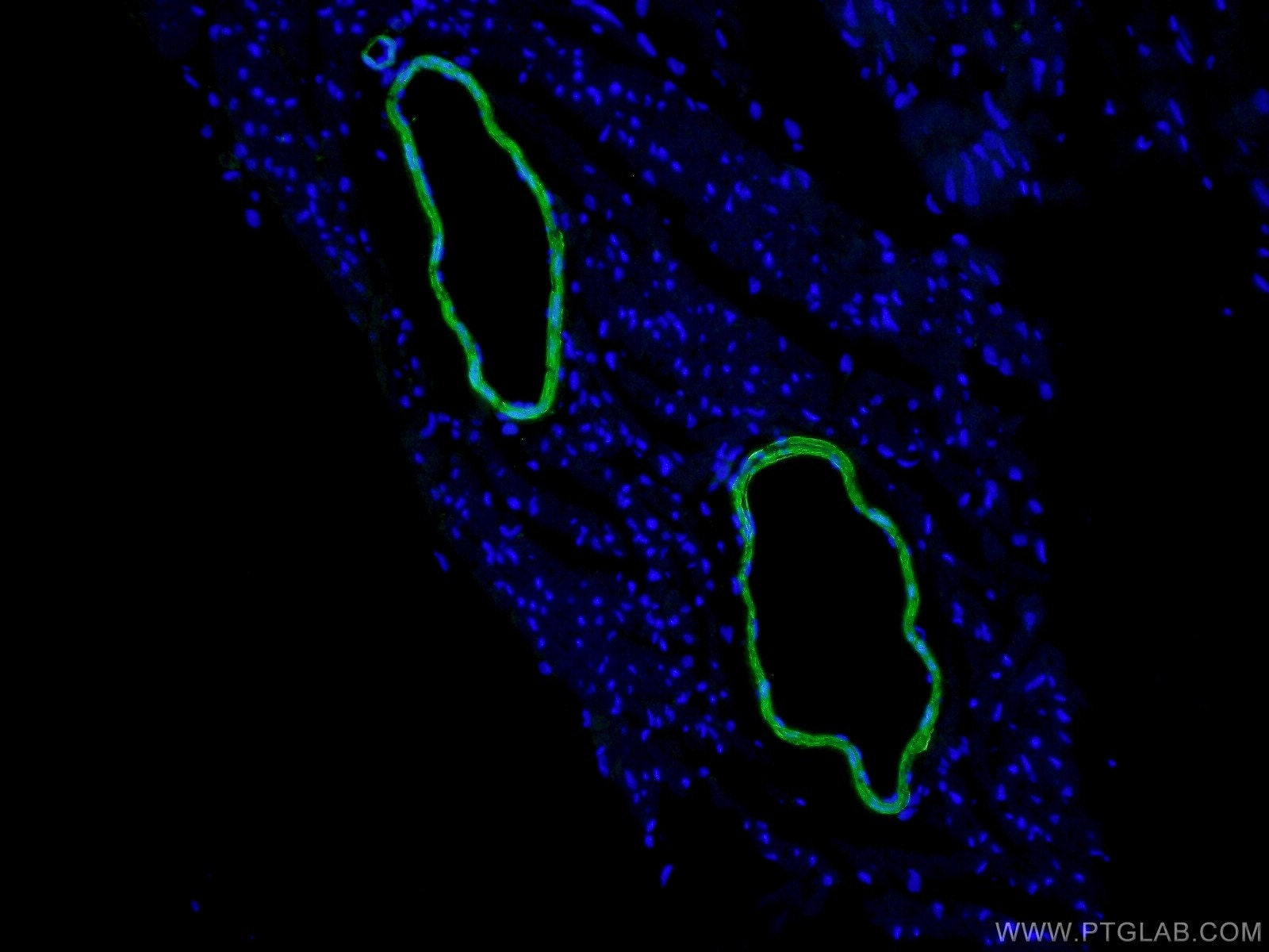 Immunofluorescence (IF) / fluorescent staining of mouse heart tissue using transgelin/SM22 Polyclonal antibody (10493-1-AP)