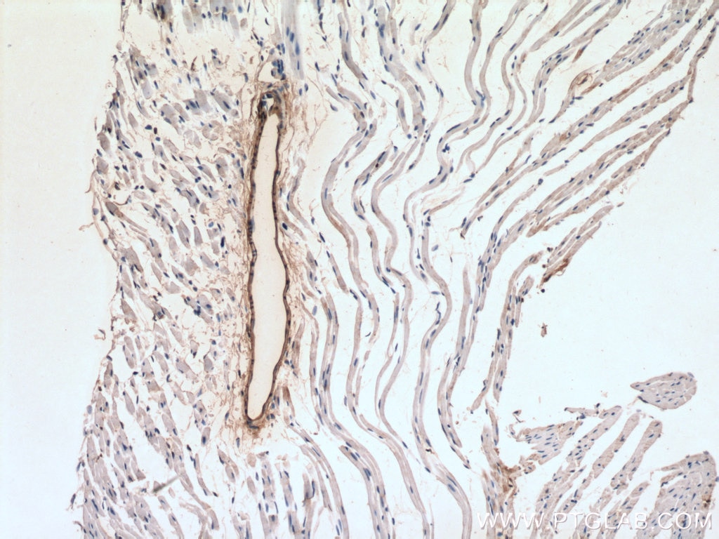 Immunohistochemistry (IHC) staining of mouse heart tissue using transgelin/SM22 Polyclonal antibody (10493-1-AP)