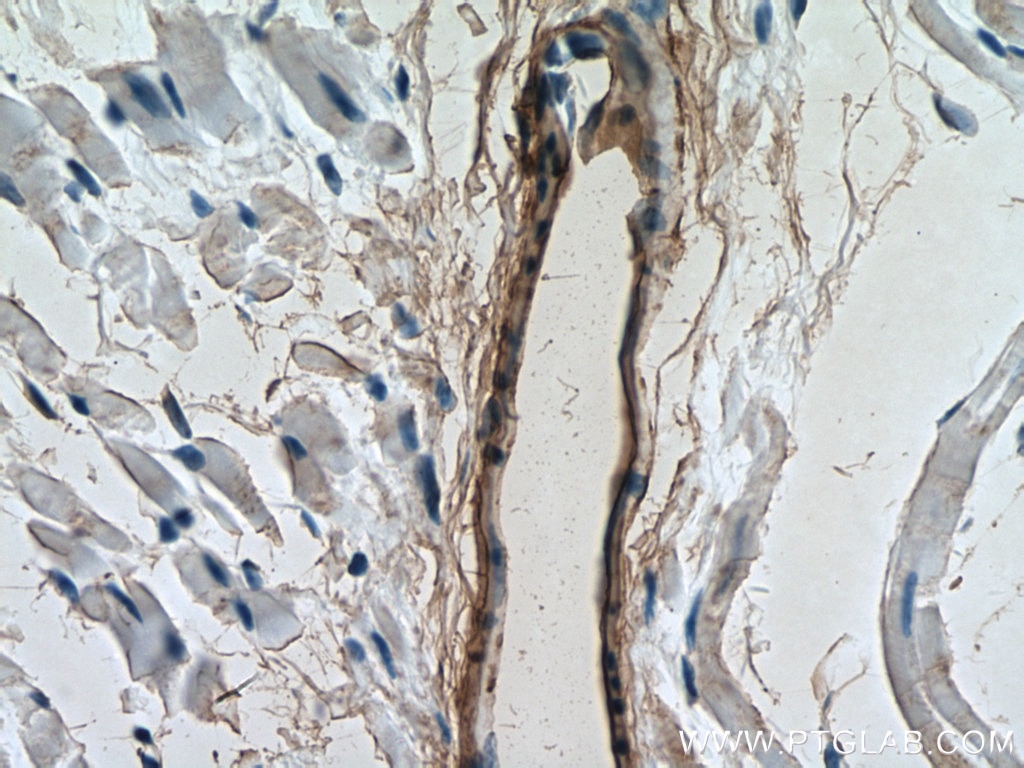 Immunohistochemistry (IHC) staining of mouse heart tissue using transgelin/SM22 Polyclonal antibody (10493-1-AP)