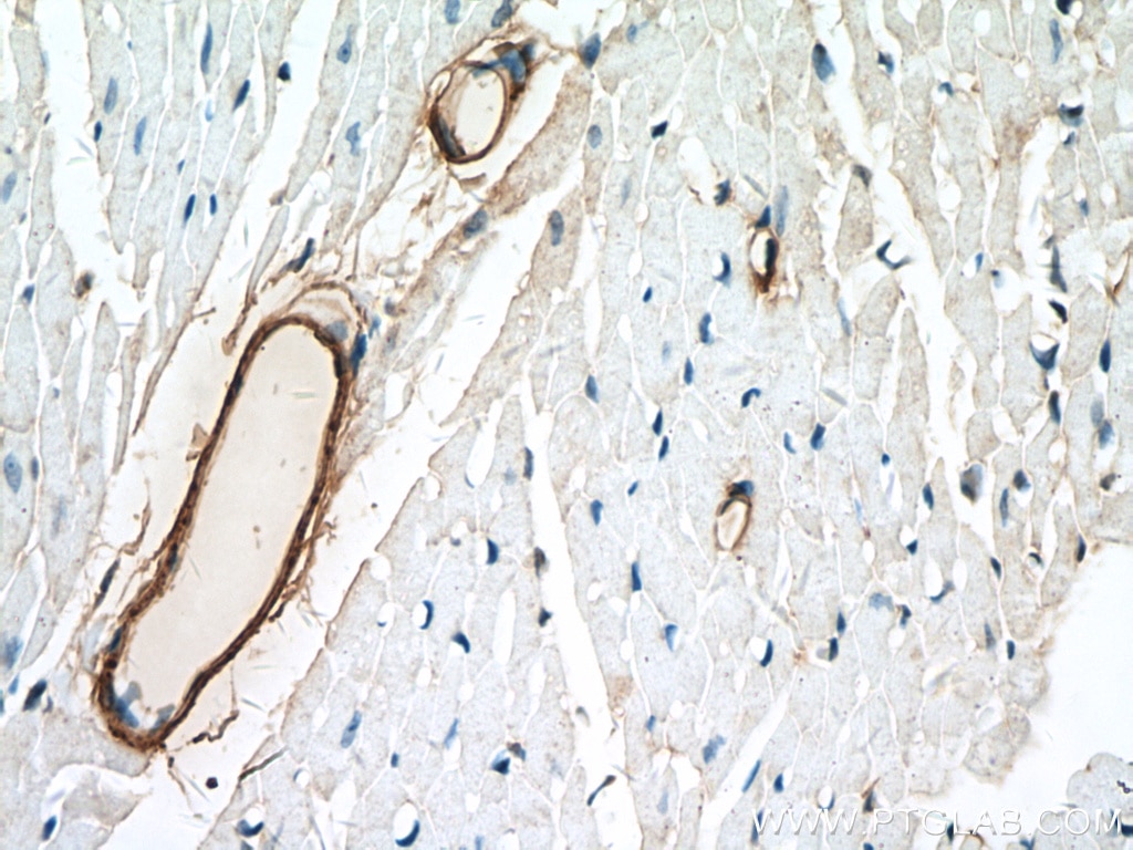 Immunohistochemistry (IHC) staining of mouse heart tissue using transgelin/SM22 Polyclonal antibody (10493-1-AP)