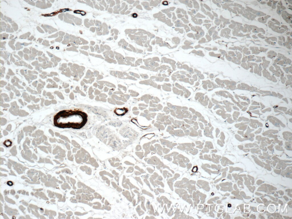 Immunohistochemistry (IHC) staining of human heart tissue using transgelin/SM22 Polyclonal antibody (10493-1-AP)