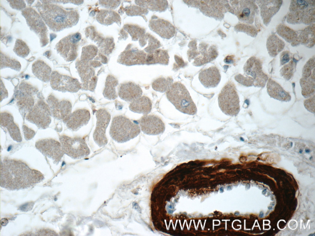Immunohistochemistry (IHC) staining of human heart tissue using transgelin/SM22 Polyclonal antibody (10493-1-AP)