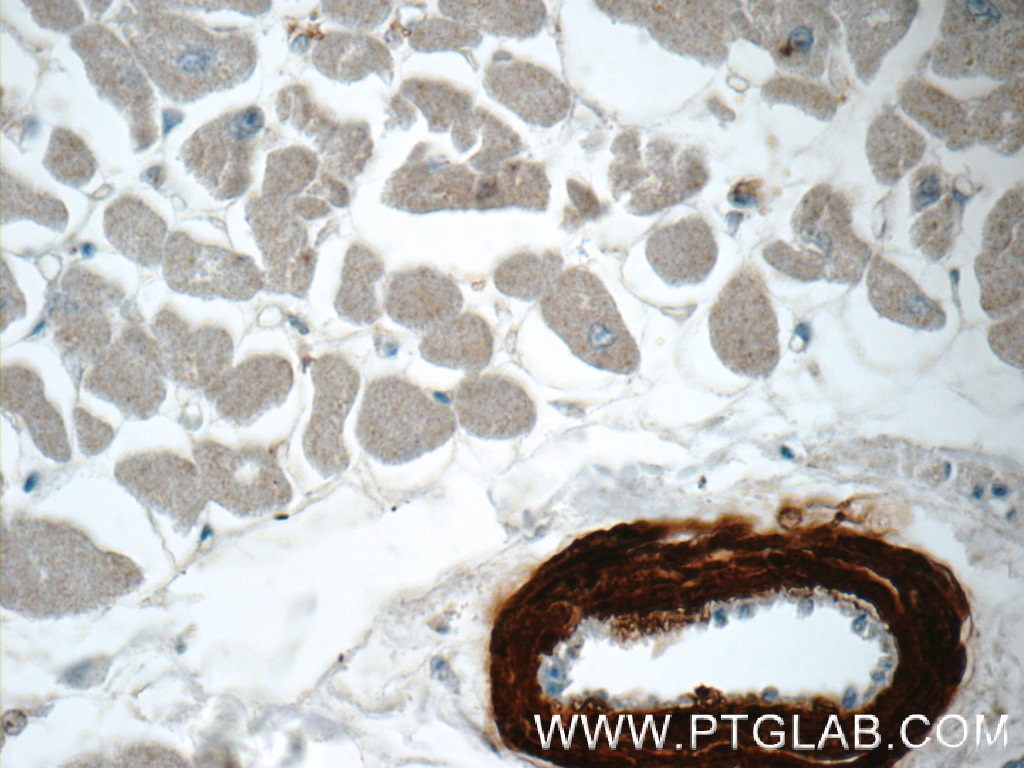 IHC staining of human heart using 10493-1-AP